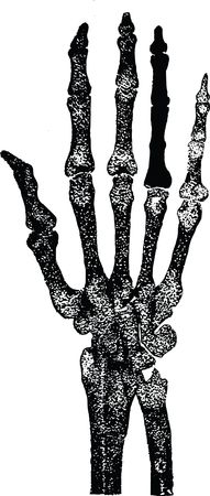 Free clipart of a skeletal hand